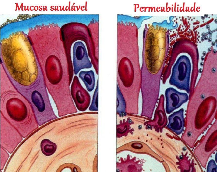 permeabilidade-intestinal.jpg