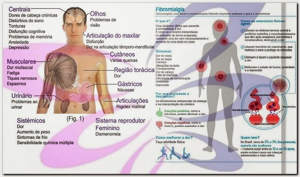 SINTOMAS DE FIBROMIALGIA