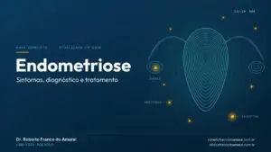 Endometriose: guia completo de sintomas, diagnóstico e tratamento